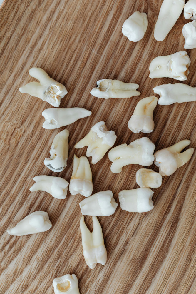 Dental Crowns