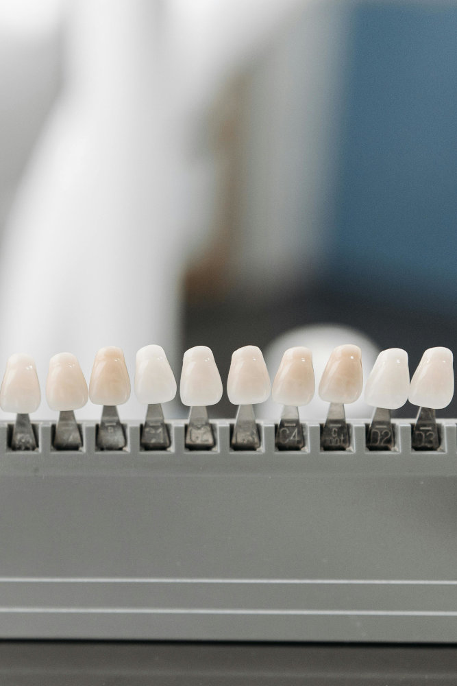 Veneers